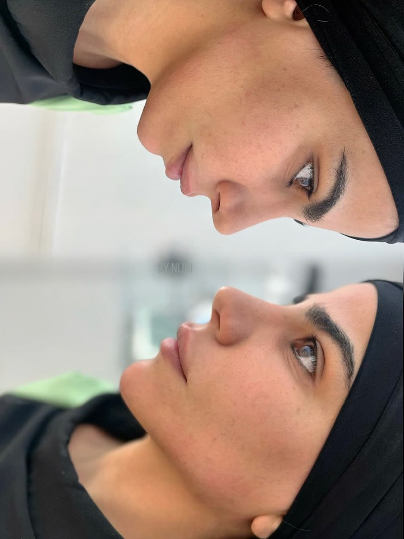 Professional LED LIGHT THERAPY FACIAL treatment at Age Reversal Clinics