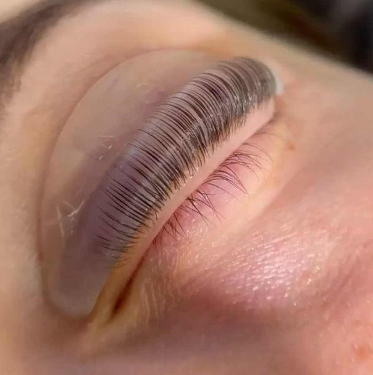 Professional GIGI WOW GOLD FACIAL treatment at Age Reversal Clinics