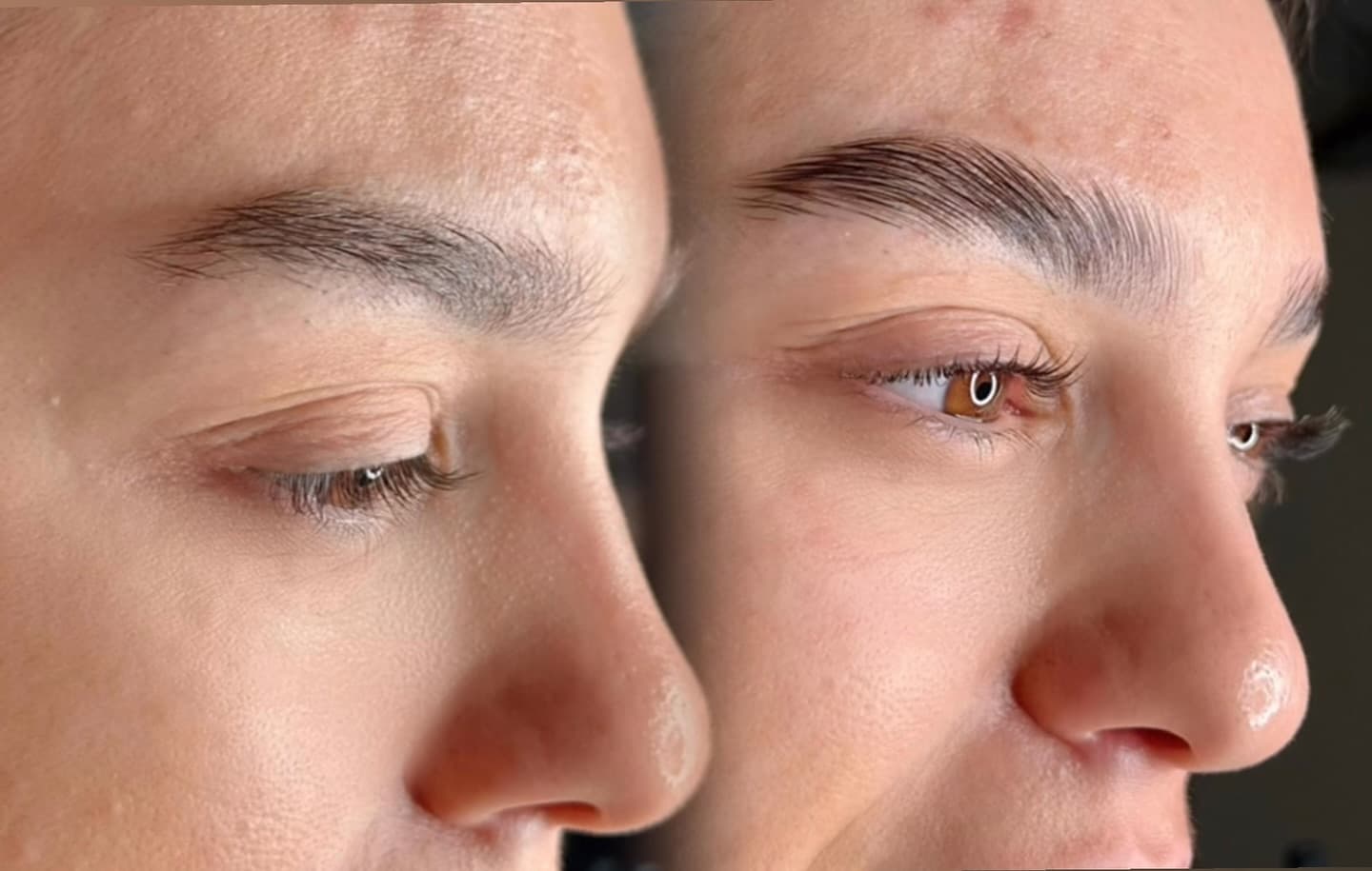 Professional PLATELET RICH PLASMA treatment at Age Reversal Clinics